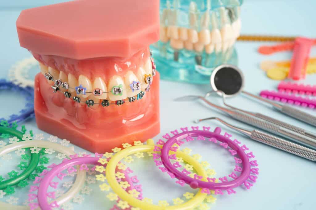 Orthodontics Bellevue